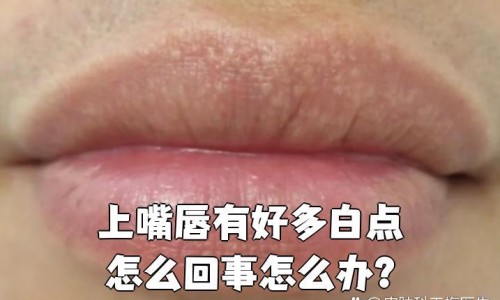月经期间做面膜过敏了是怎么回事-专业经期敷面膜最佳时间平台-大姨妈期间面膜会比平时吸收好吗